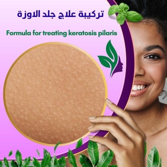تركيبة علاج جلد الاوزة  