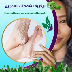 تركيبة تشققات القدمين